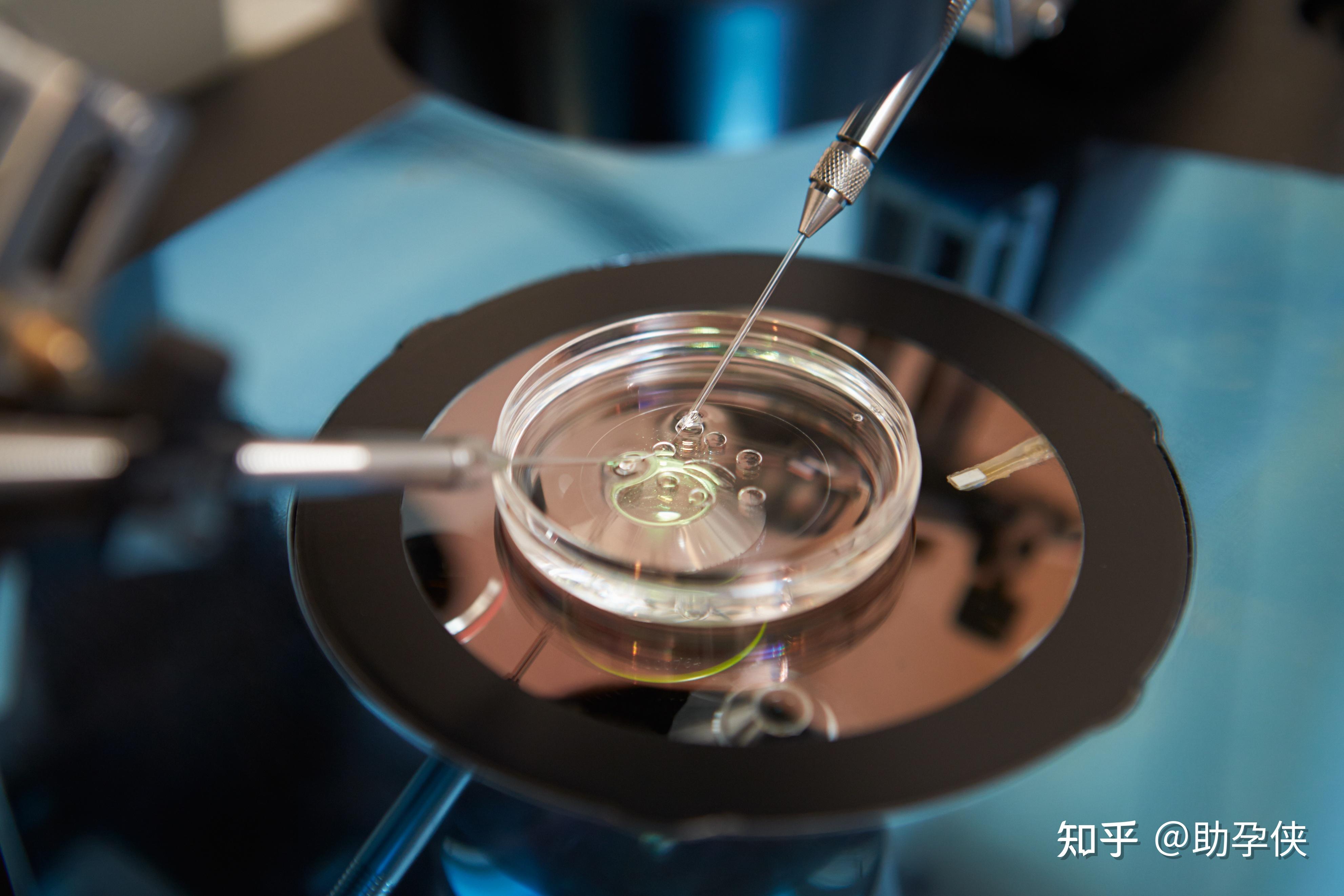 泉州无精试管婴儿