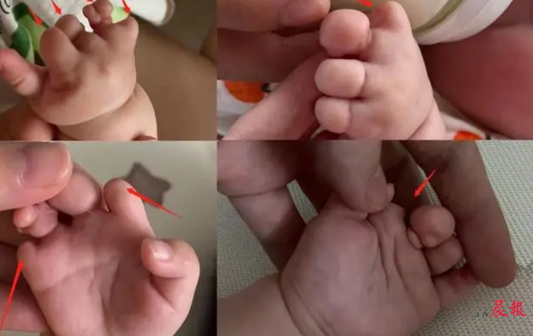 健康管理师