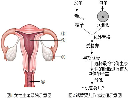 人流手术