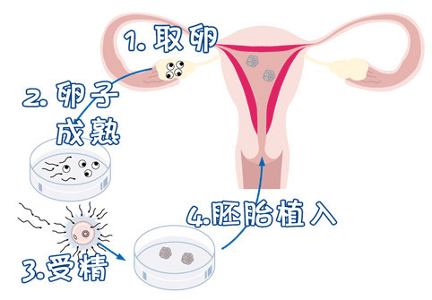 药物流产