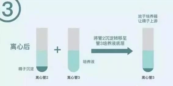 早孕反应