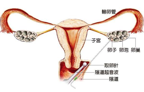 停经多久可以测试出早孕