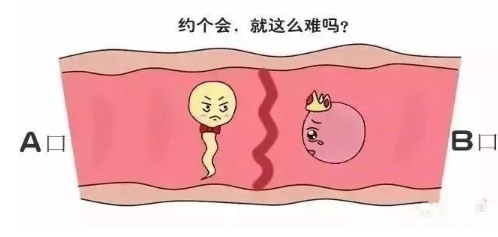 流产