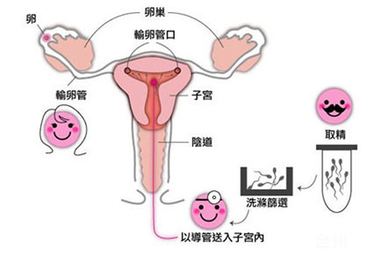 早早孕试纸